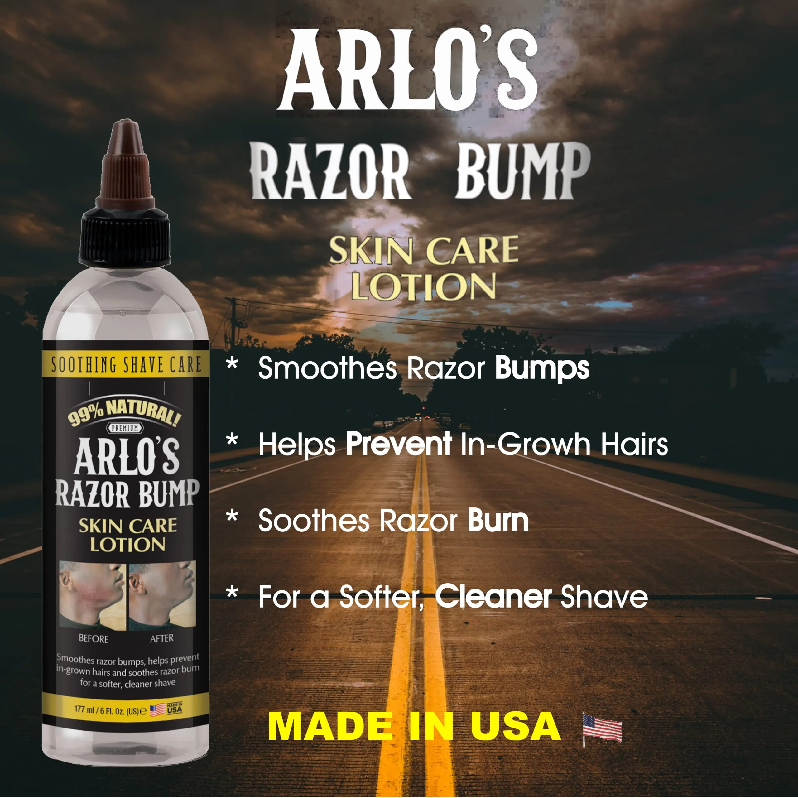 Arlos Razor Bump Skin Care Lotion 177ml